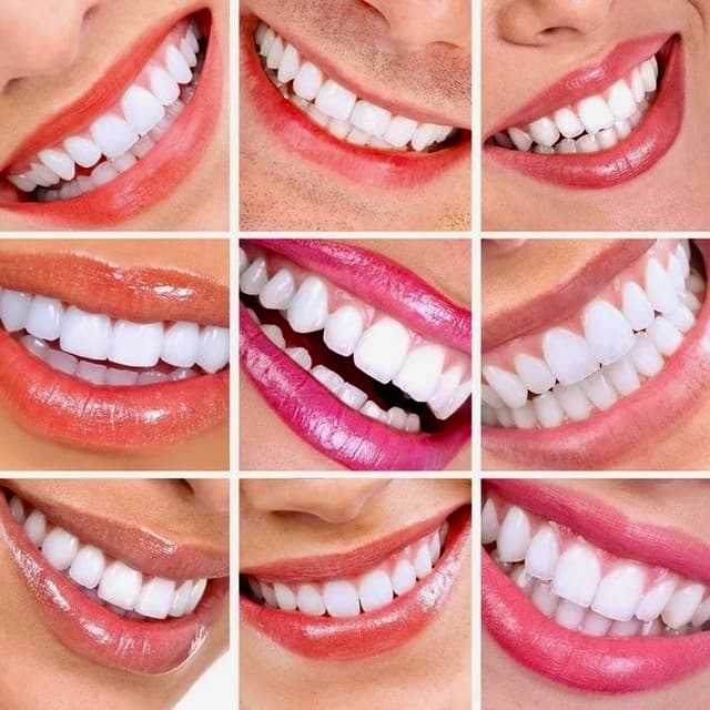 Signature Smile Glow Package at The Teacup Body Sculpt & Glow in Hillside, IL